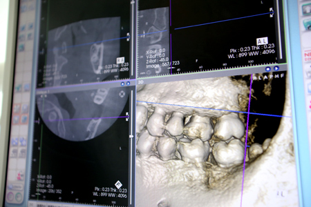 ［画像］歯科用CT